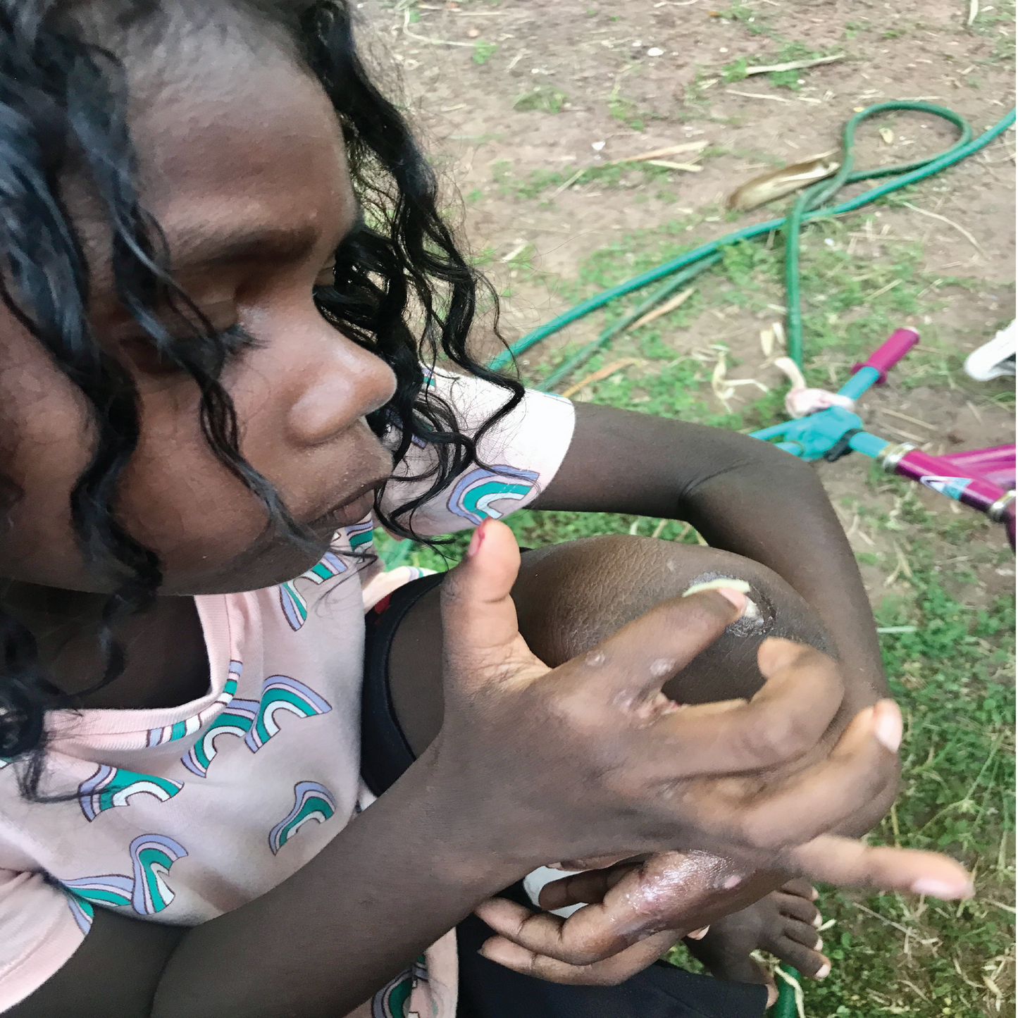 Donate a balm to Yolŋu